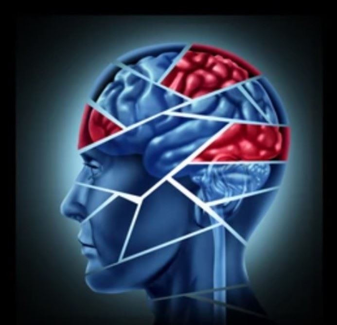 understanding-traumatic-brain-injuries